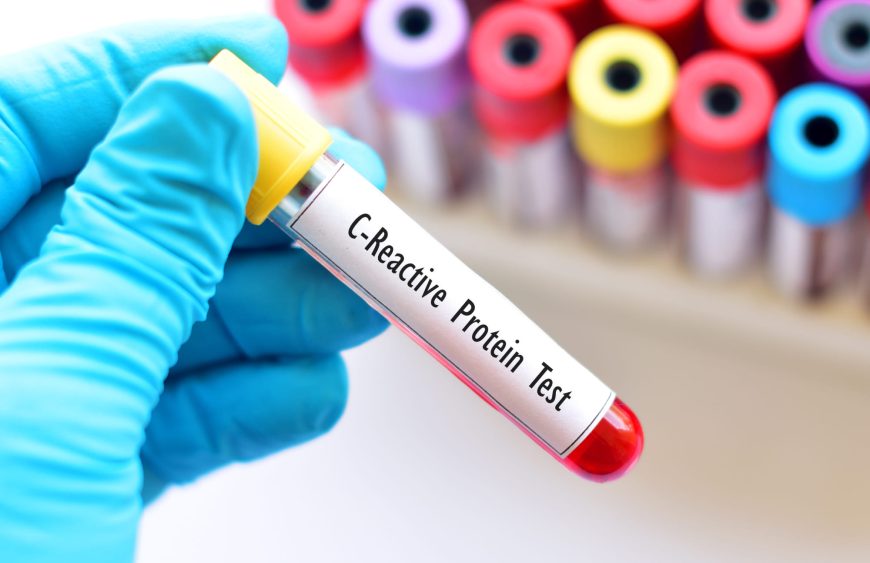 Examineme.co.uk - CRP Test